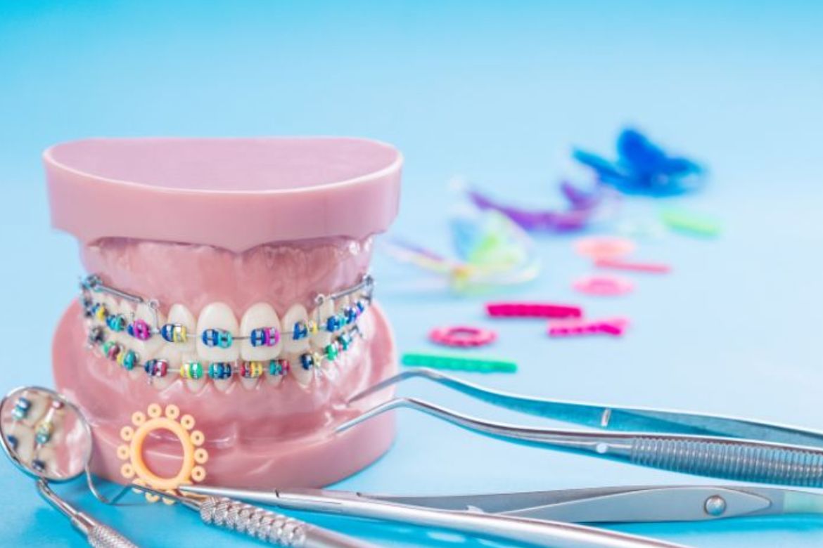 orthodontic