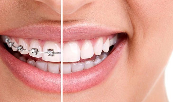 orthodontic